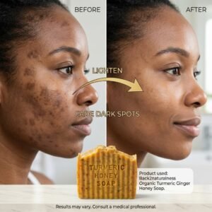 Turmeric Soap for Dark Spots